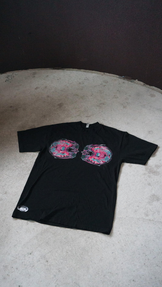 X-RAY BRAIN TEE