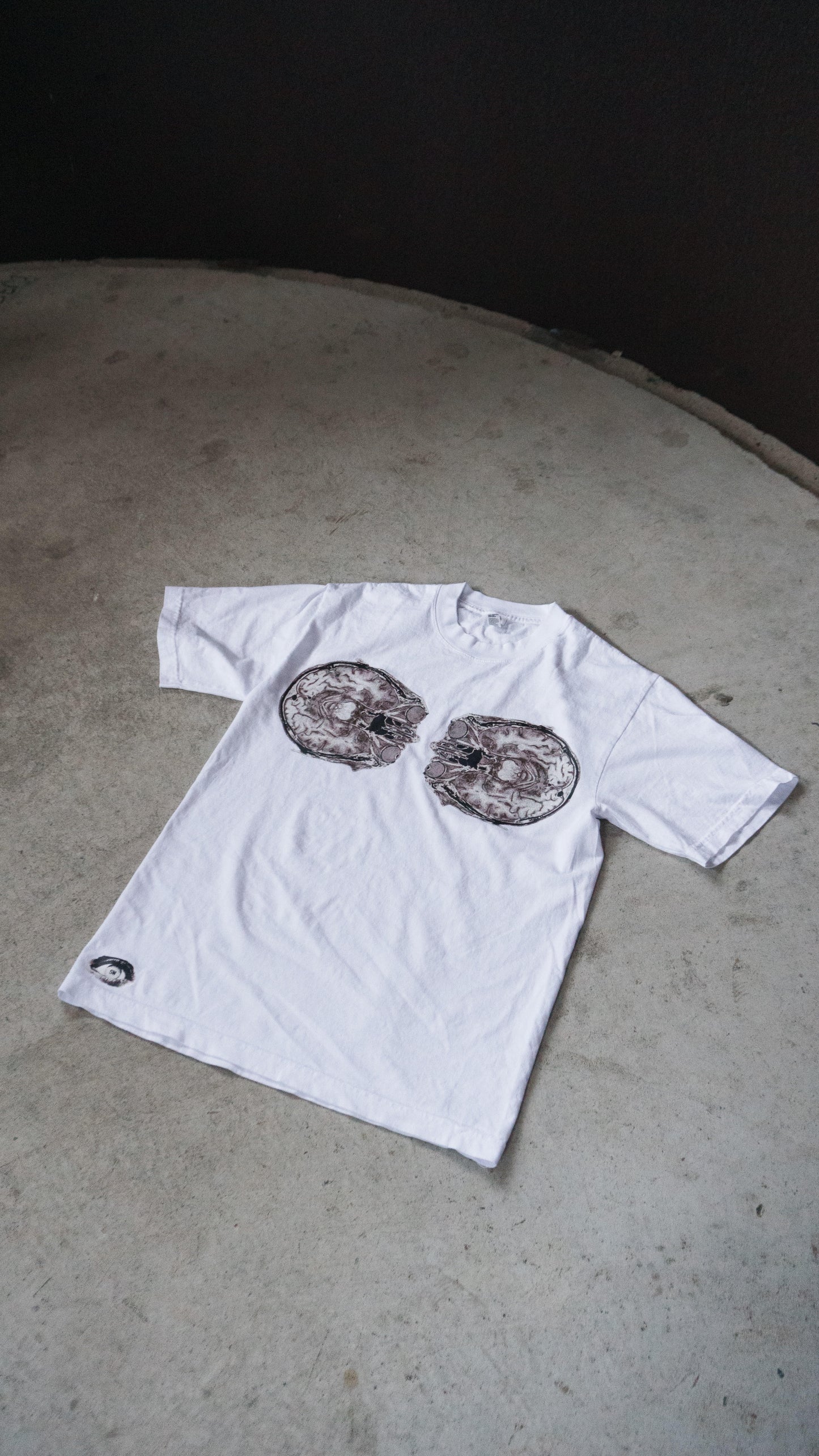 X-RAY BRAIN TEE